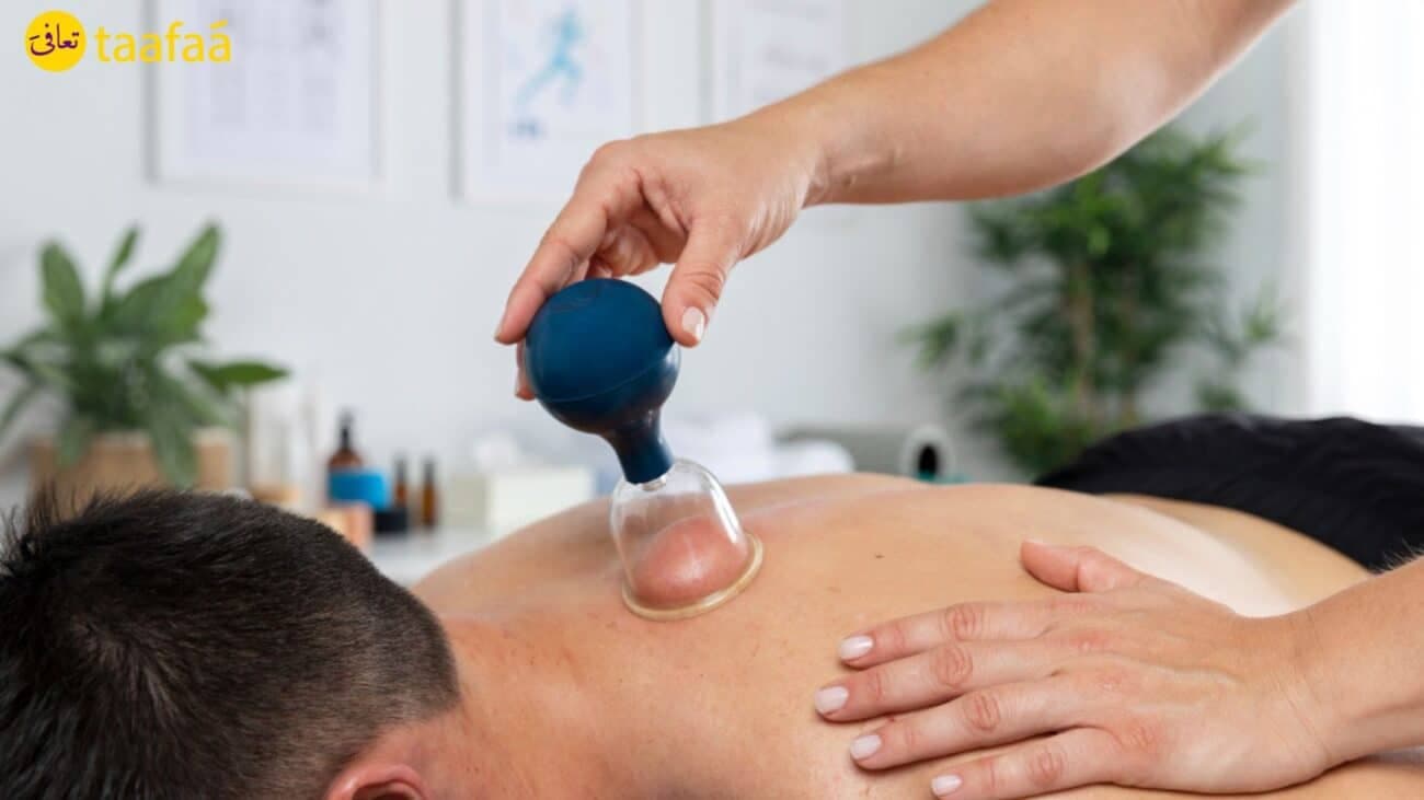 Cupping Therapy in All Its Forms