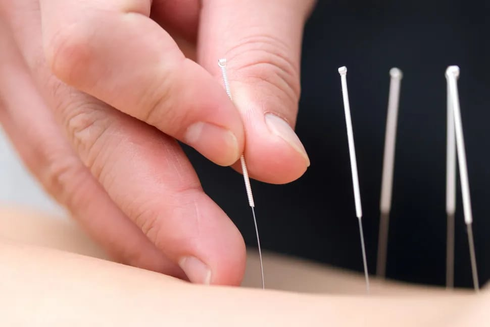 El zohor clinic Acupuncture